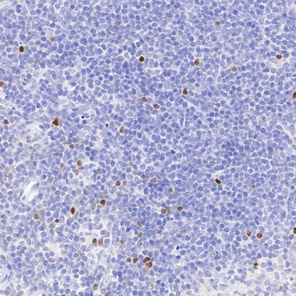 TBR2/Eomes Recombinant Rabbit mAb (SDT-1101-231)