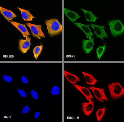 BCAR1 Recombinant Rabbit mAb (S-3542-49)