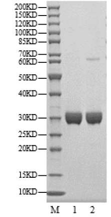 PIM1 Protein, Human