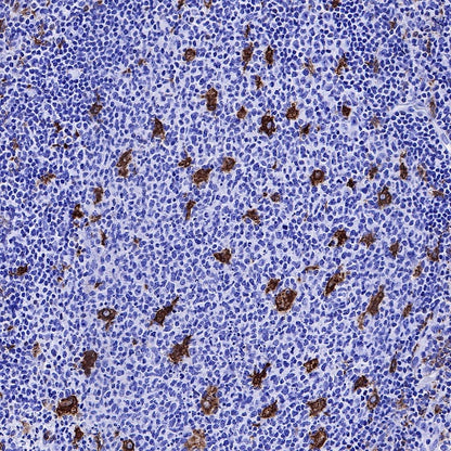 Heme Oxygenase 1 Recombinant Rabbit mAb (S-R334)