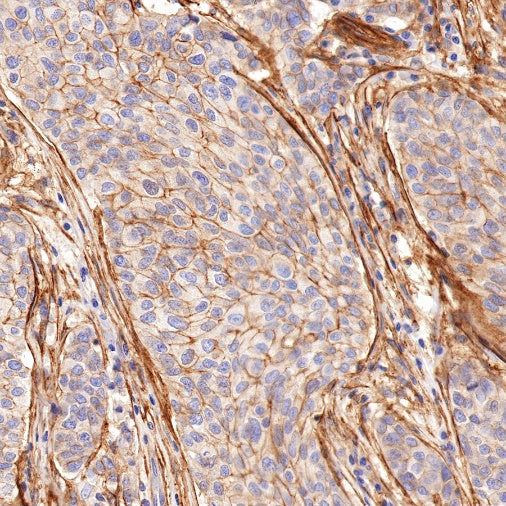 Integrin alpha V Recombinant Rabbit mAb (S-1798-27)