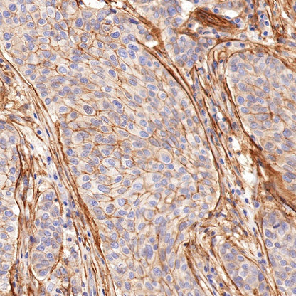 Integrin alpha V Recombinant Rabbit mAb (S-1798-27)