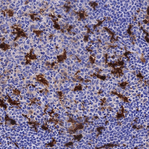 IL-18 Recombinant Rabbit mAb (S-2142-2)