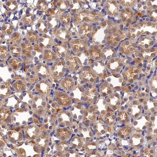 Peroxiredoxin 3 Rabbit Polyclonal Antibody