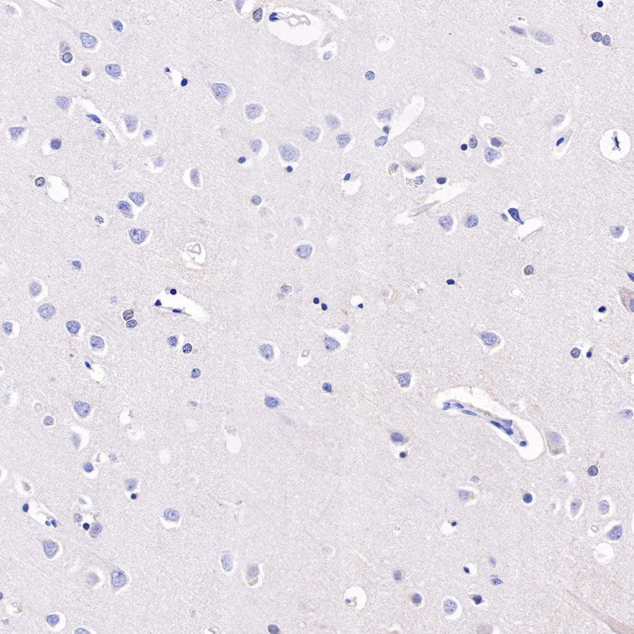CD42b Recombinant Rabbit mAb (SDT-R147)