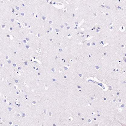 CD42b Recombinant Rabbit mAb (SDT-R147)