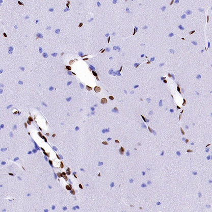FOXC1 Recombinant Rabbit mAb (S-1607-142)