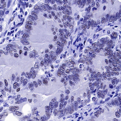 S-RMab® PMS2 Recombinant Rabbit mAb (SDT-R460)