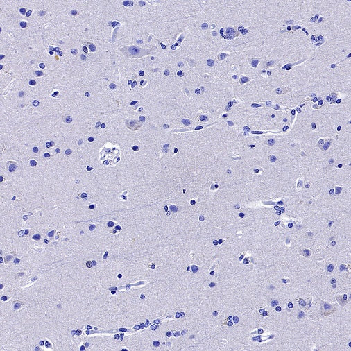 CACNA1S Recombinant Rabbit mAb (S-2448-78)
