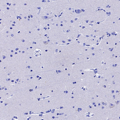 CACNA1S Recombinant Rabbit mAb (S-2448-78)