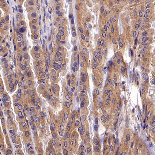 KIF5B+KIF5C Recombinant Rabbit mAb (S-2452-15)