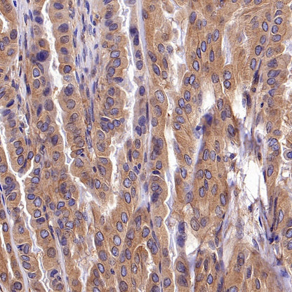KIF5B+KIF5C Recombinant Rabbit mAb (S-2452-15)