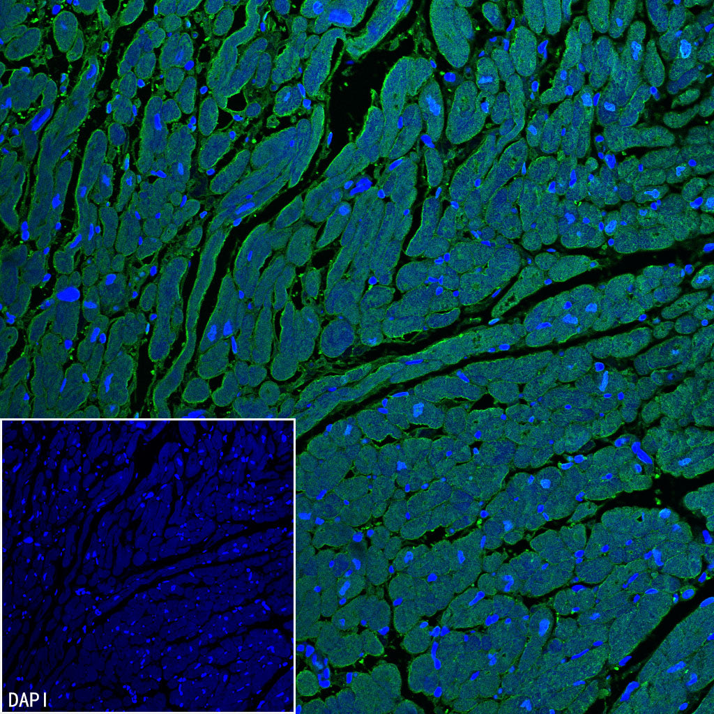 Myoglobin Recombinant Rabbit mAb (S-6197)
