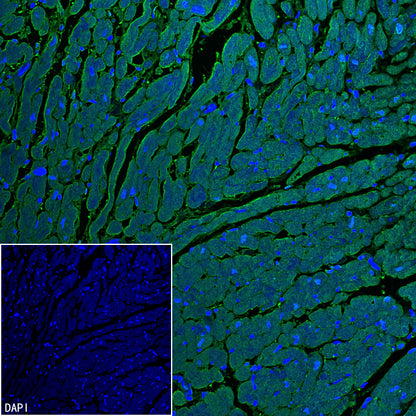 Myoglobin Recombinant Rabbit mAb (S-6197)