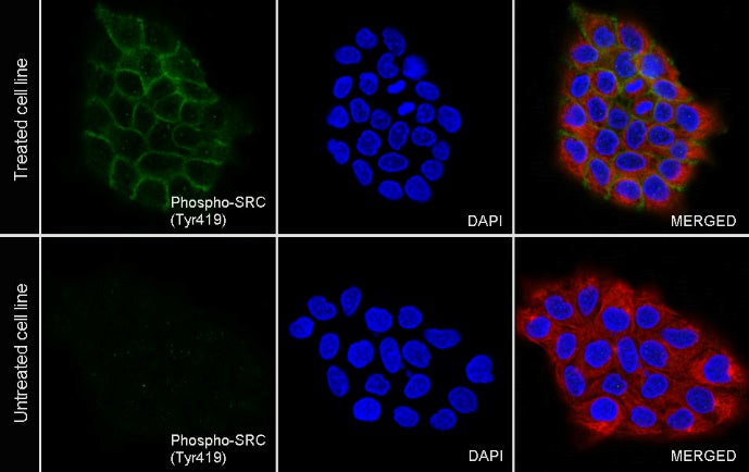 Phospho-SRC (Tyr419) Recombinant Rabbit mAb (S-1182-5)