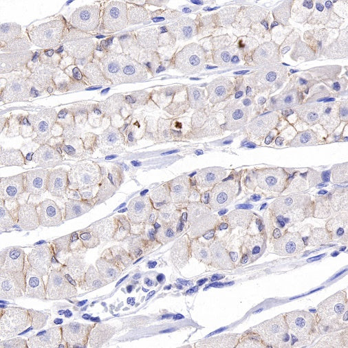 ROR1 Recombinant Rabbit mAb (SDT-R502)