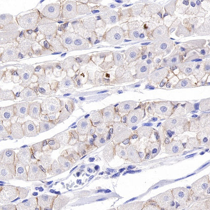ROR1 Recombinant Rabbit mAb (SDT-R502)