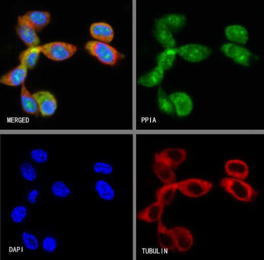 PPIA Recombinant Rabbit mAb (S-2406-28)
