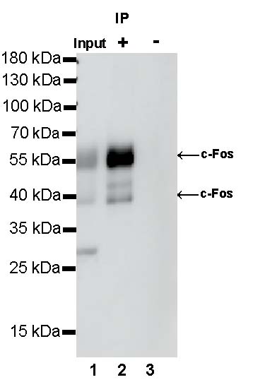 c-Fos Recombinant Rabbit mAb (S-1391-63)