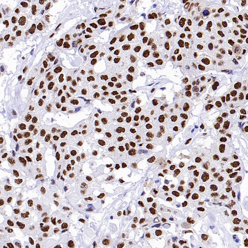 ENT2 Rabbit Polyclonal Antibody