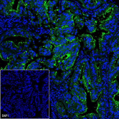 ENPP3/CD203c Recombinant Rabbit mAb (S-1632-11)