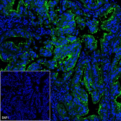 ENPP3/CD203c Recombinant Rabbit mAb (S-1632-11)