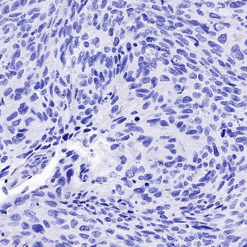 DLL3 Recombinant Rabbit mAb (S-207-179)