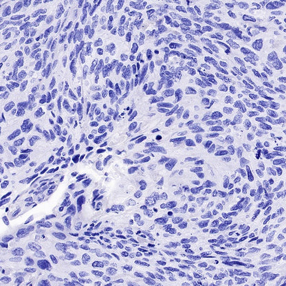 DLL3 Recombinant Rabbit mAb (S-207-179)