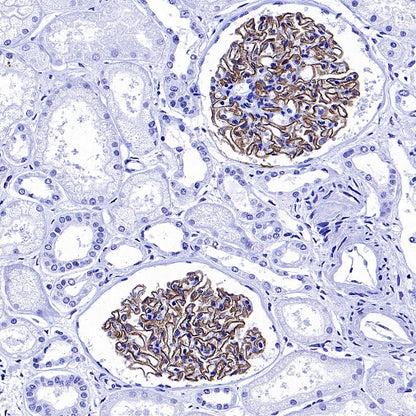 NPHS1 Recombinant Rabbit mAb (SDT-2148-63)
