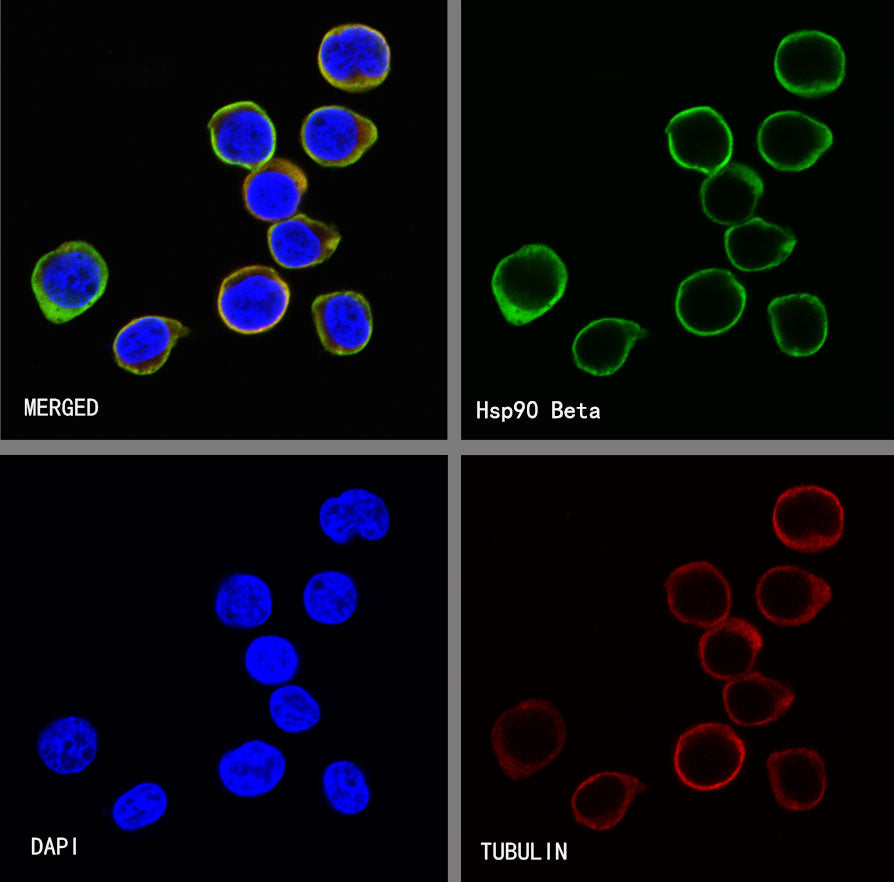 Hsp90 beta Recombinant Rabbit mAb (SDT-R033)