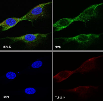KRAS Recombinant Rabbit mAb (S-R291)