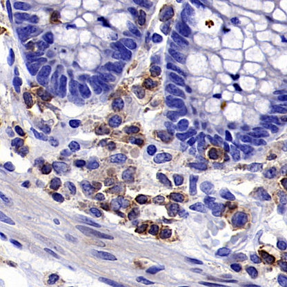Claudin 9 Recombinant Rabbit mAb (S-2849-16)