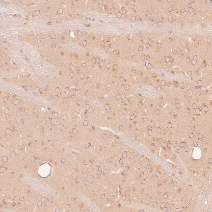 RB1CC1 Recombinant Rabbit mAb (S-2367-251)