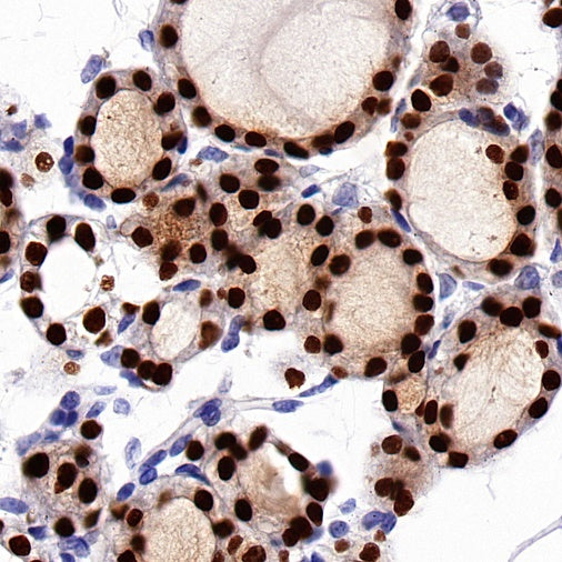 PAX8 Recombinant Rabbit mAb (SDT-R509)