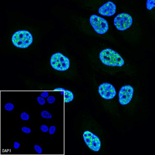 PCNA Recombinant Rabbit mAb (Alexa Fluor® 488 Conjugate) (SDT-297-116)