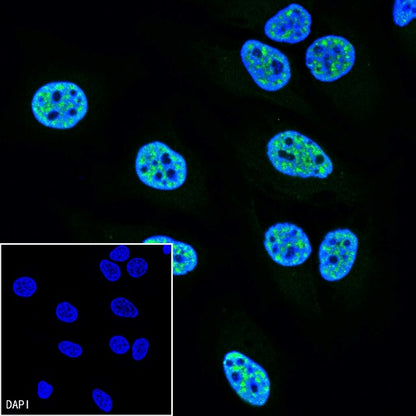PCNA Recombinant Rabbit mAb (Alexa Fluor® 488 Conjugate) (SDT-297-116)
