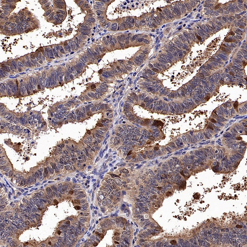 GCLM Recombinant Rabbit mAb (S-2209-19)
