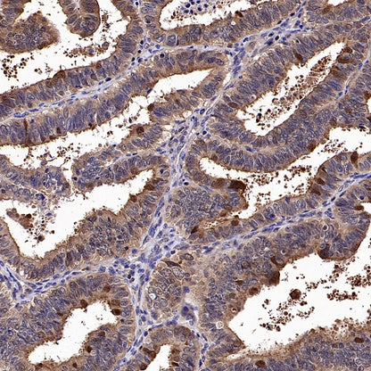 GCLM Recombinant Rabbit mAb (S-2209-19)