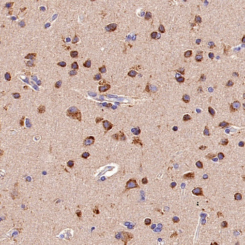 TMEM106B Recombinant Rabbit mAb (S-2362-33)