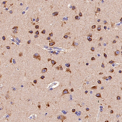 TMEM106B Recombinant Rabbit mAb (S-2362-33)
