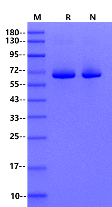 phi29 DNA Polymerase