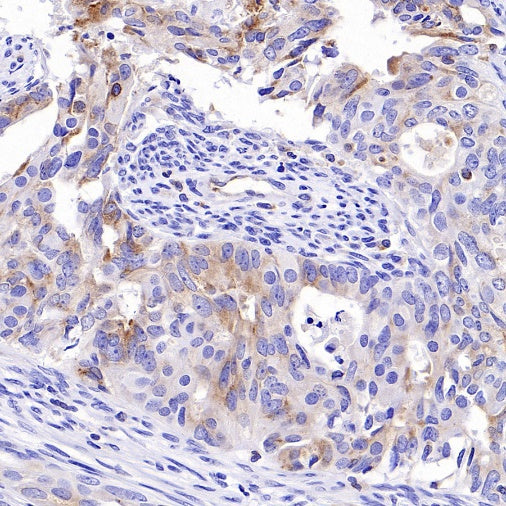 Progranulin Recombinant Rabbit mAb (S-2202-59)