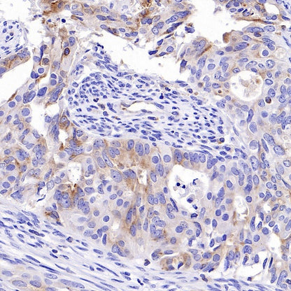 Progranulin Recombinant Rabbit mAb (S-2202-59)