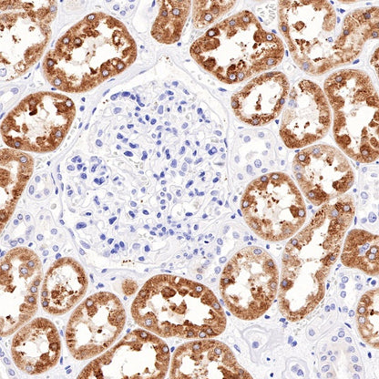 COX2 Recombinant Rabbit mAb (SDT-380-259)