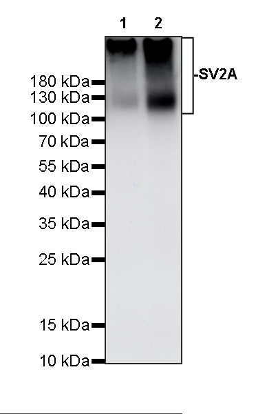 SV2A Recombinant Rabbit mAb (S-4049-16)