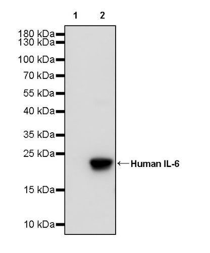 Anti-Human IL-6 Monoclonal Antibody (Siltuximab)