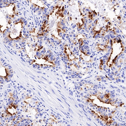 Spink1 Recombinant Rabbit mAb (S-R249)