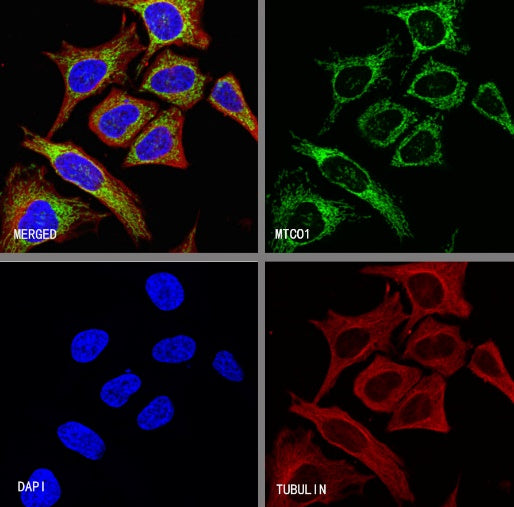 MTCO1 Recombinant Rabbit mAb (S-2205-28)