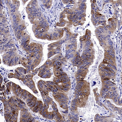 Anterior Gradient 2 Rabbit Polyclonal Antibody