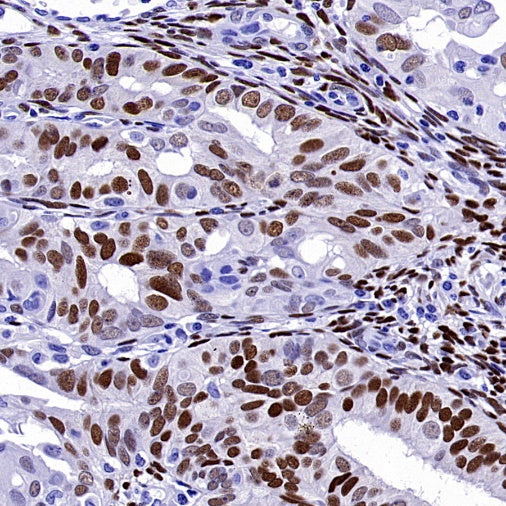 ER alpha Recombinant Rabbit mAb (SDT-2950-36)